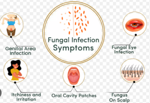 Infection symptoms
