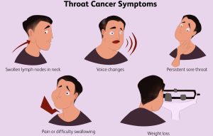 throat cancer symptoms