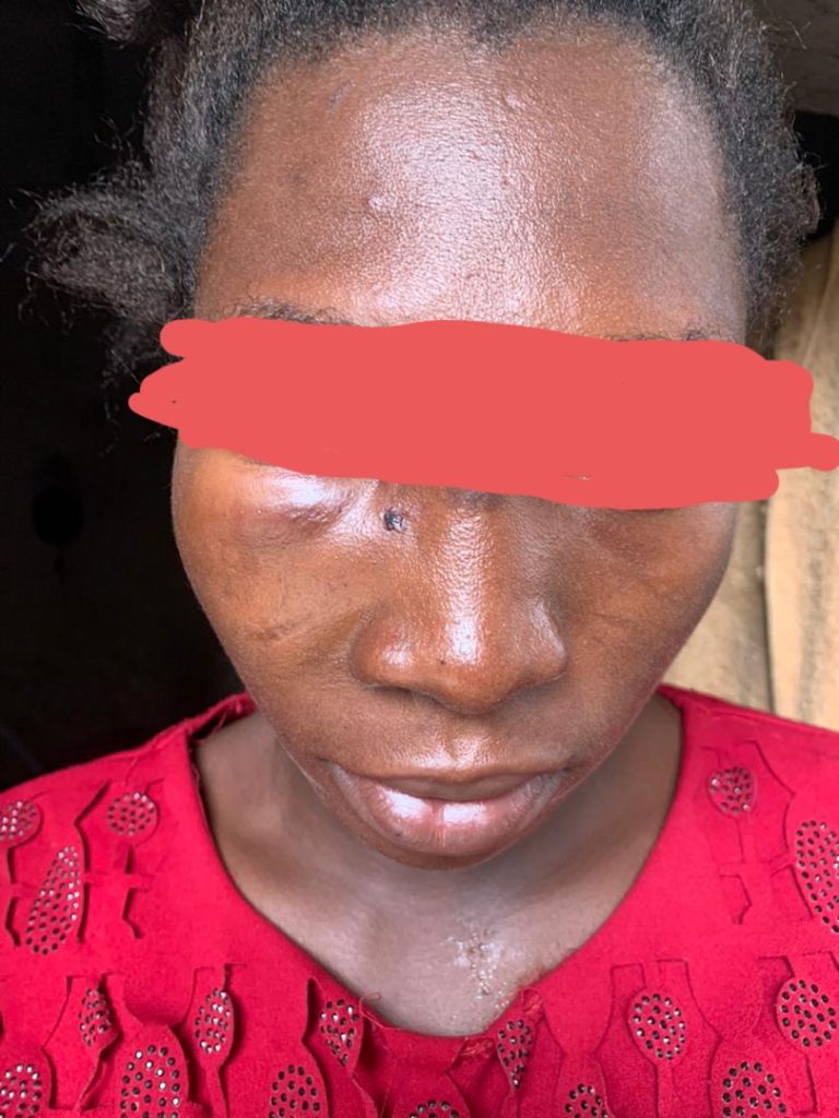 Pregnant woman cries for help amidst abusive marriage