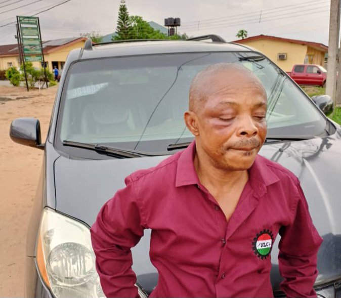 Brutalised NLC president Ajaero to undergo eye exam, brain scan, spine therapy