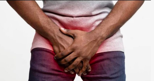 Unconventional sex positions can result in penile fracture, doctors warn