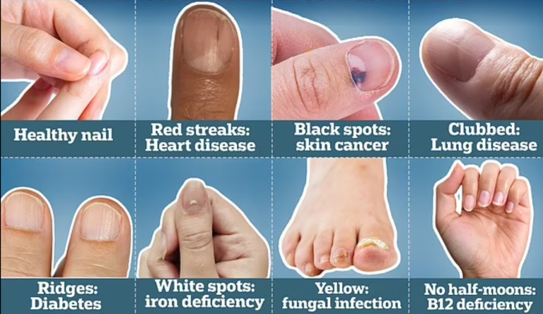 Nail health signs you shouldn’t ignore!