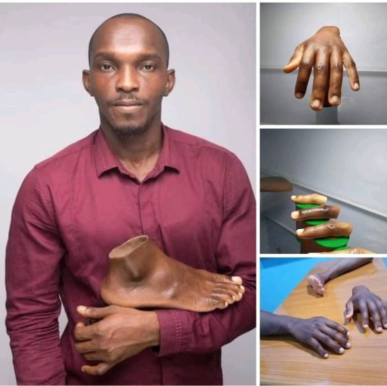 John Amanam: Mixing empathy with artistic flair to create bespoke prosthetic pieces