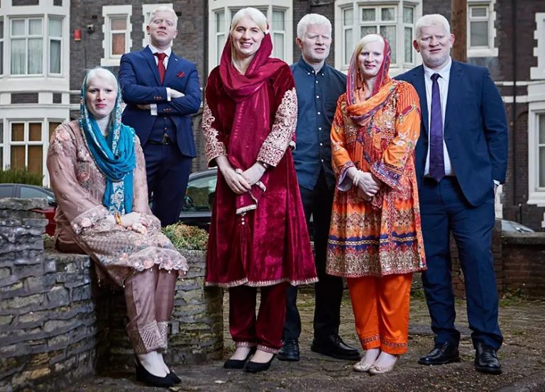 VIDEO: Family of albinos breaks Guinness World Record