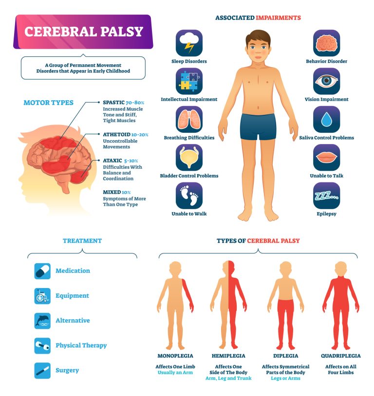 Therapist urges prompt action against cerebral palsy