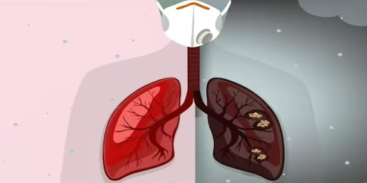 Effects of air pollution on lungs