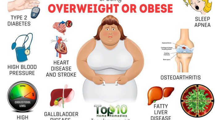Obesity and overweight